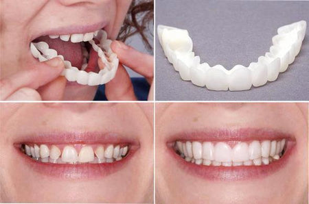AMAZING PERFECT& CONFIDENT SMILE - ZefTe