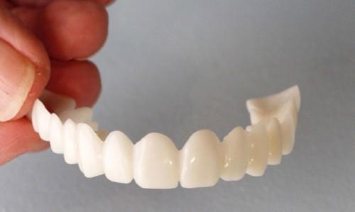 Best  Snap-On Smile Amazing Perfect & Confident Smile Clip-On  Veneers. - ZefTe