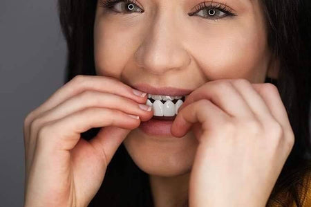 Snap-On Veneers – A Bright Look