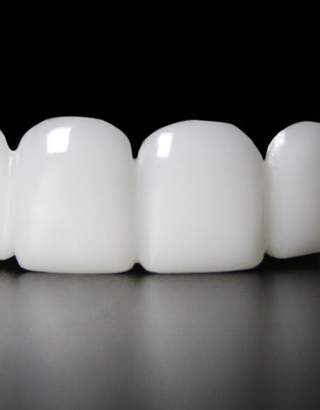 Snap On Veneer Smille-Best Quality Snap On Veneers.