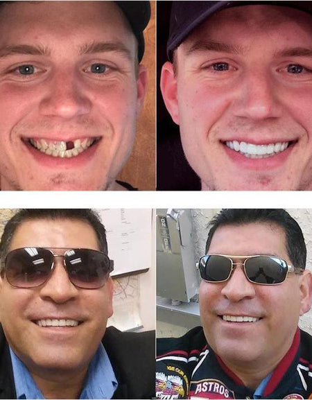 Zefte Snap On Veneers Clip On Teeth Cover Women & Men New 2018 Design one size - ZefTe