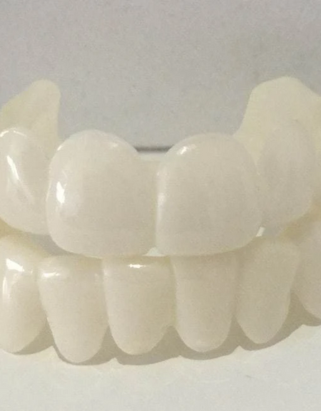 Snap On Veneers-Fake Teeth veneers that look natural.