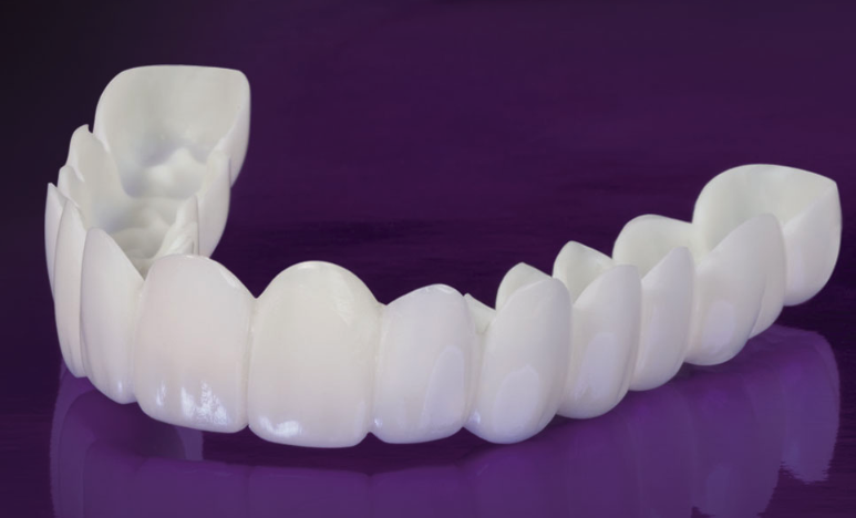 Snap On Veneers Top and Bottom - ZefTe