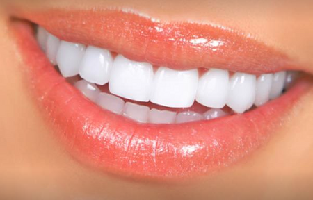 Amazing Perfect-Confident Smile|Teeth Covers - ehabal